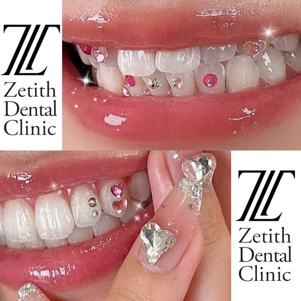 ティースジュエリー