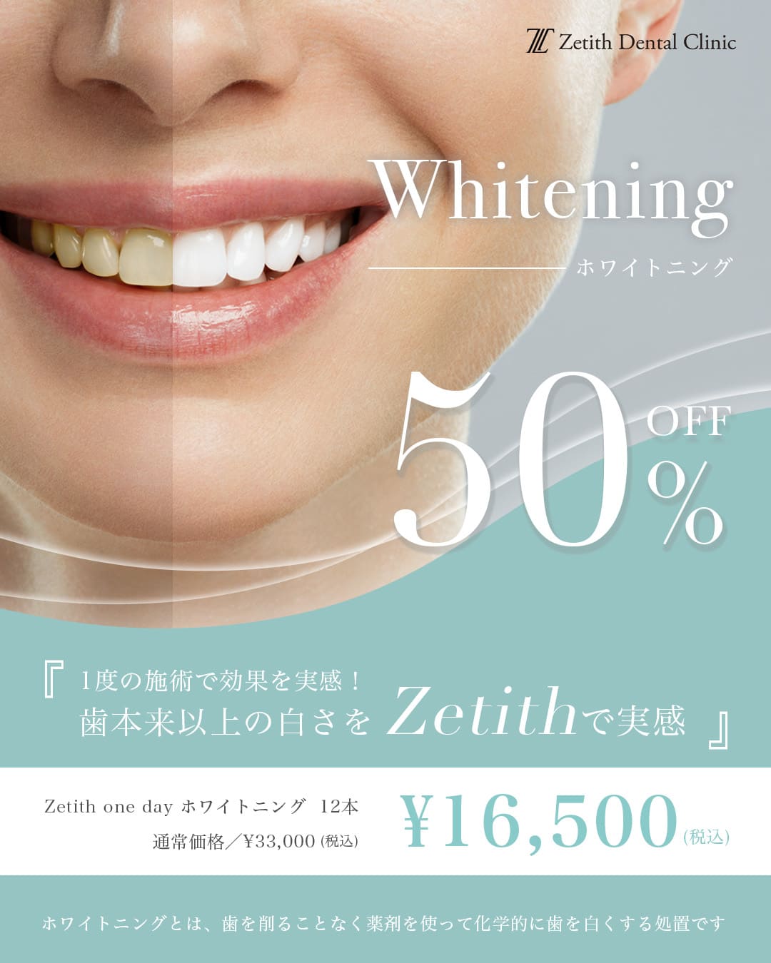 ホワイトニング50%OFF